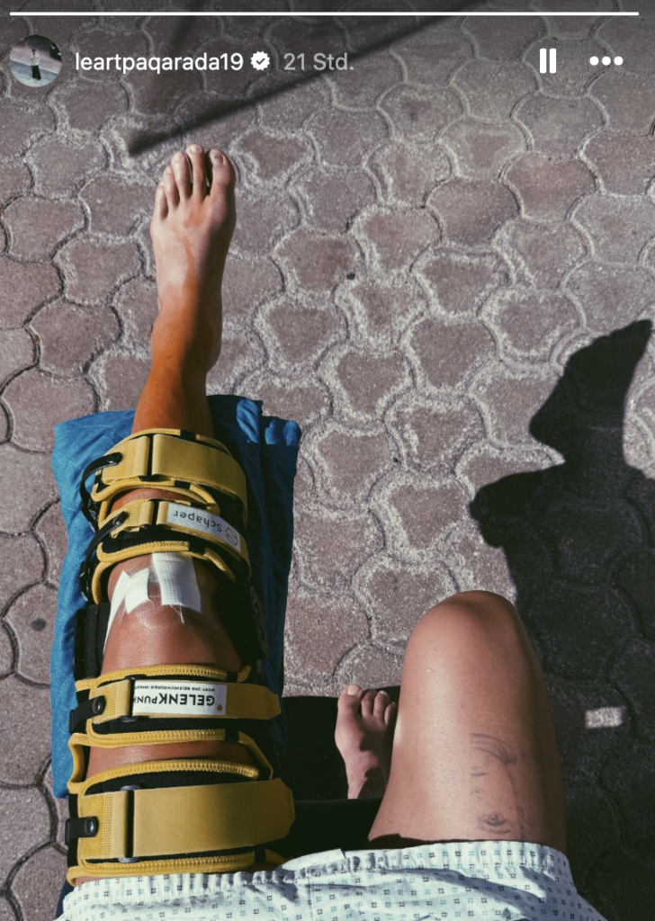 Leart Paqarada zeigte auf Social Media sein verletztes Knie.